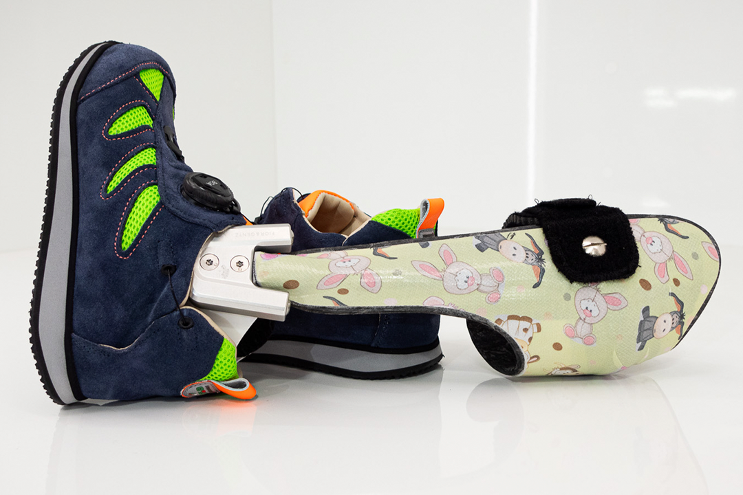 leistungen_orthopaedietechnik_kinderversorgung